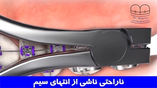 ناراحتی ناشی از انتهای سیم ارتودنسی | دکتر احسان ابوئی مهریزی