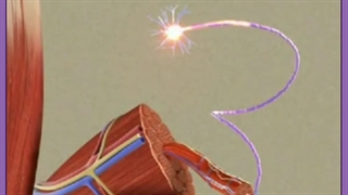 تزریق بوتاکس دور چشم | هزینه، عوارض، مزایا و مراقبت ها