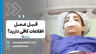 تا چه اندازه برای عمل بینی آماده‌اید؟