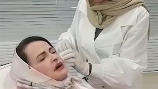تزریق مزوژل در مازندران