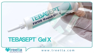 ژل ایکس طباسپت تریتا چیست