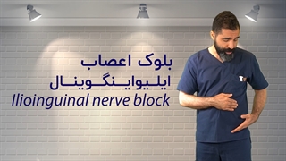 بلوک اعصاب ایلیواینگوینال