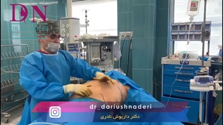 لیپوماتیک