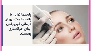 هزینه و مزایای بی شمار پلاسما جت پلک
