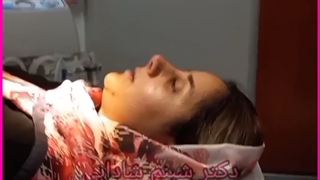 بلافاصله بعد از بازکردن گچ