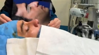 فیلم عمل بینی طبیعی مردانه