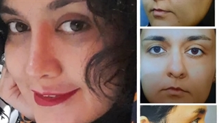 حدود یک سال پس از جراحی زیبایی بینی به سبک نچرال استتیک