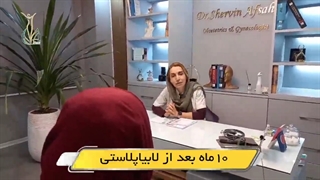 ده ماه پس از لابیاپلاستی