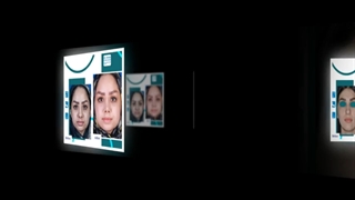 تصاویر قبل و بعد از جراحی بینی توسط دکتر مهدی غلامی بهترین جراح بینی در مشهد