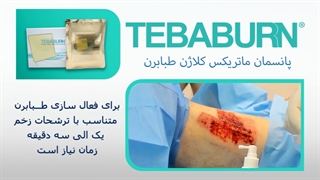 نحوه استفاده از طبابرن