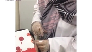 فیلم پی آر پی صورت