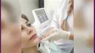 لیفت و درمان غبغب با روش های بدون جراحی