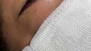 کاشت ابرو طبیعی