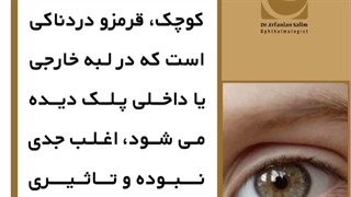 آیا تجربه گل مژه داشتید؟