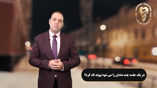 در یک جلسه چند دندان را می شود پیوند لثه کرد؟