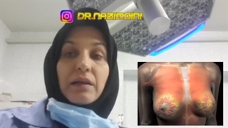 انکوماموریداکشن