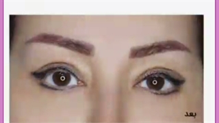عوارض جراحی پلک