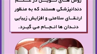 بلیچینگ یا جرم گیری؟