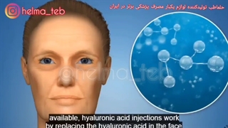 فیلرهای هیالورونیک اسید