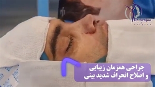 جراحی همزمان زیبایی و اصلاح انحراف شدید بینی