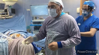 اسلیوگاسترکتومی در اطفال