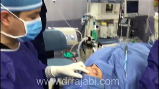 جراحی توده ابرو و بازسازی با فلپ اسلایدینگ