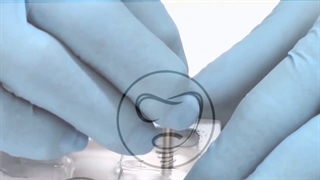 دکتر وحید دهقان : مینی ایمپلنت