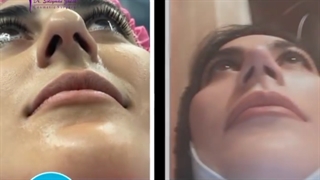 جراحی انجام شده توسط دکتر پژوا سلیمان زاده