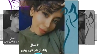 جراحی های انجام شده توسط دکتر پژوا سلیمان زاده