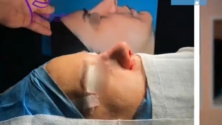 جراحی همزمان بینی و پلک