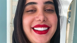 ۸ واحد لمینت سرامیکی ایمکس