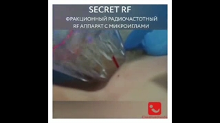 جوانسازی و لیفت پوست Secret RF