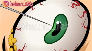 تریپانوفوبیا یا سوزن هراسی