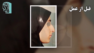 جراحی بینی نیمه فانتزی در اتاق عمل