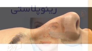 فیلم واقعی و بدون سانسور از رینوپلاستی در اتاق عمل