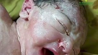 تولد رایان کوچولو