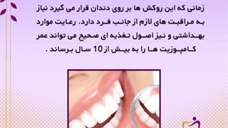 کامپوزیت دندان چقدر ماندگاری دارد؟ اتوپلاستی
