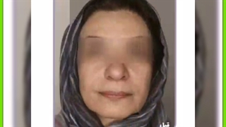 مراقبت های بعد از هایفوتراپی