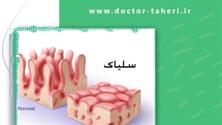 بیماری سلیاک