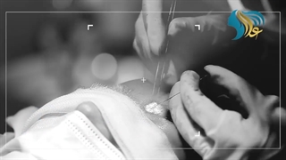 فیلم کاشت ابرو روی تتو ابرو!!