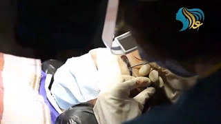 فیلم واقعی بدون سانسور کاشت ابرو!!