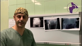 دررفتگی پروتز مصنوعی و درمان آن | دکتر کاوه قرنی زاده