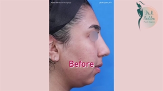 نمونه عمل بینی