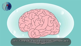 آسیب ضربهای مغز