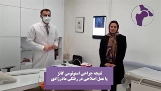 نتیجه جراحی استوتومی گانز | دکتر کاوه قرنی زاده اینسایزینگ