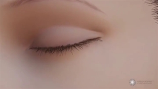 جراحی انتروپیون