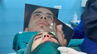 فیلم عمل زیبایی بینی