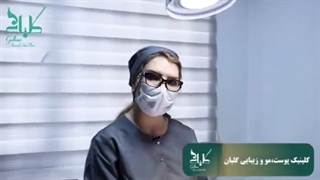 روش میکروترنفسر در کاشت مو
