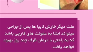 رفع سریع خارش واژن