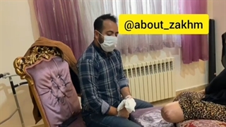 موضوع:آمپوتاسیون
